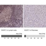 SCAF11 Antibody in Immunohistochemistry (IHC)