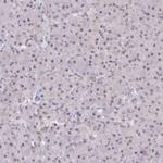 SCAF11 Antibody in Immunohistochemistry (IHC)