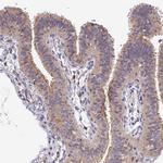 DENND5B Antibody in Immunohistochemistry (Paraffin) (IHC (P))