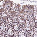 DENND5B Antibody in Immunohistochemistry (Paraffin) (IHC (P))