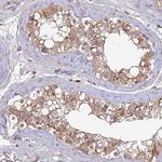 DENND5B Antibody in Immunohistochemistry (Paraffin) (IHC (P))
