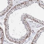 TTC40 Polyclonal Antibody