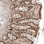 TTC40 Antibody in Immunohistochemistry (Paraffin) (IHC (P))