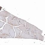 TTC40 Antibody in Immunohistochemistry (Paraffin) (IHC (P))