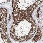 TTC40 Antibody in Immunohistochemistry (IHC)