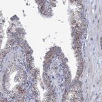 NDUFC2 Polyclonal Antibody