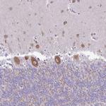 Pellino 3 Antibody in Immunohistochemistry (IHC)
