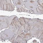 GTSF1 Antibody in Immunohistochemistry (Paraffin) (IHC (P))