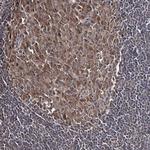 GTSF1 Antibody in Immunohistochemistry (Paraffin) (IHC (P))