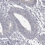 GTSF1 Antibody in Immunohistochemistry (Paraffin) (IHC (P))