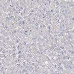 GTSF1 Antibody in Immunohistochemistry (Paraffin) (IHC (P))