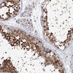 GTSF1 Antibody in Immunohistochemistry (Paraffin) (IHC (P))