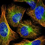 ANKRD10 Polyclonal Antibody