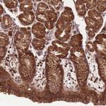 ANKRD10 Antibody in Immunohistochemistry (Paraffin) (IHC (P))
