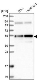ANKRD10 Antibody in Western Blot (WB)