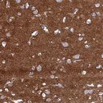 C12orf73 Antibody in Immunohistochemistry (IHC)
