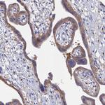 C12orf73 Antibody in Immunohistochemistry (IHC)