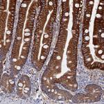 C12orf73 Antibody in Immunohistochemistry (IHC)