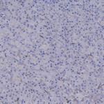 C12orf73 Antibody in Immunohistochemistry (IHC)