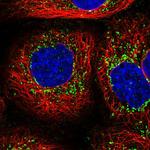 MYL6B Polyclonal Antibody