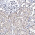 MYL6B Antibody in Immunohistochemistry (Paraffin) (IHC (P))
