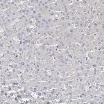MYL6B Antibody in Immunohistochemistry (Paraffin) (IHC (P))