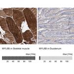 MYL6B Antibody in Immunohistochemistry (IHC)