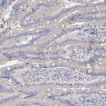 MYL6B Antibody in Immunohistochemistry (IHC)