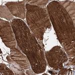 MYL6B Antibody in Immunohistochemistry (IHC)