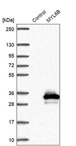 MYL6B Antibody in Western Blot (WB)