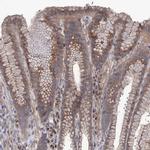 SEC24A Antibody in Immunohistochemistry (Paraffin) (IHC (P))