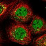 PPHLN1 Polyclonal Antibody