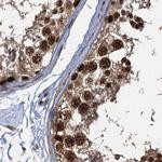 PPHLN1 Antibody in Immunohistochemistry (IHC)