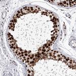 PSPC1 Antibody in Immunohistochemistry (IHC)