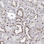 PSPC1 Antibody in Immunohistochemistry (IHC)