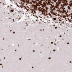 PSPC1 Antibody in Immunohistochemistry (IHC)