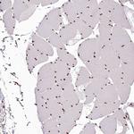 PSPC1 Antibody in Immunohistochemistry (IHC)