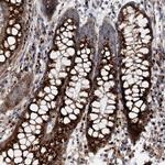 FAM48A Antibody in Immunohistochemistry (Paraffin) (IHC (P))