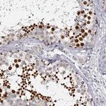 RBMXL2 Antibody in Immunohistochemistry (Paraffin) (IHC (P))