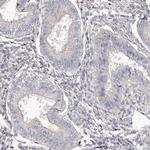 RBMXL2 Antibody in Immunohistochemistry (IHC)