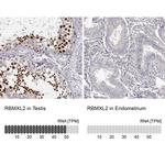 RBMXL2 Antibody