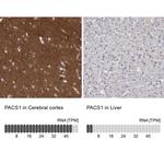 PACS1 Antibody
