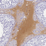 CFHR1 Antibody in Immunohistochemistry (Paraffin) (IHC (P))