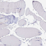 CFHR1 Antibody in Immunohistochemistry (Paraffin) (IHC (P))