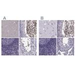 ODF3 Polyclonal Antibody