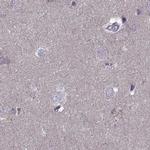 ODF3 Antibody in Immunohistochemistry (IHC)