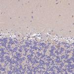 CFHR1 Antibody in Immunohistochemistry (Paraffin) (IHC (P))
