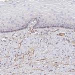 CFHR1 Antibody in Immunohistochemistry (Paraffin) (IHC (P))