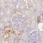 CFHR1 Antibody in Immunohistochemistry (Paraffin) (IHC (P))