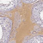 CFHR1 Antibody in Immunohistochemistry (Paraffin) (IHC (P))